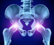 Depuy ASR Hip